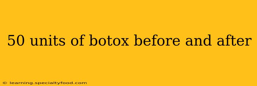50 units of botox before and after