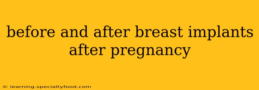 before and after breast implants after pregnancy