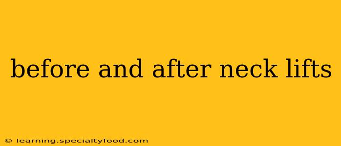 before and after neck lifts