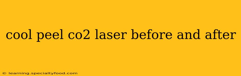 cool peel co2 laser before and after