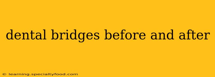 dental bridges before and after