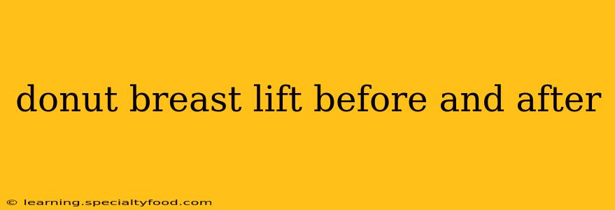 donut breast lift before and after