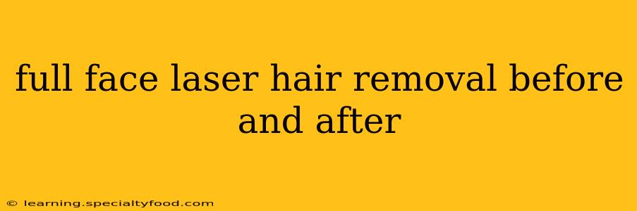 full face laser hair removal before and after