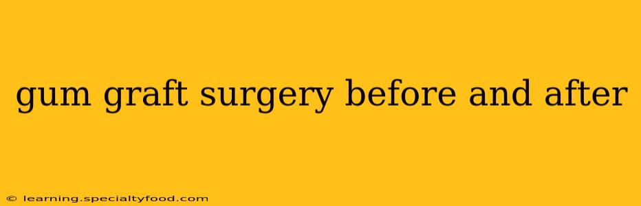 gum graft surgery before and after