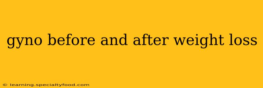 gyno before and after weight loss