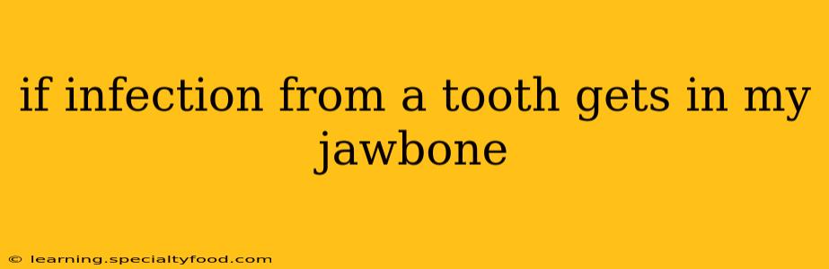 if infection from a tooth gets in my jawbone