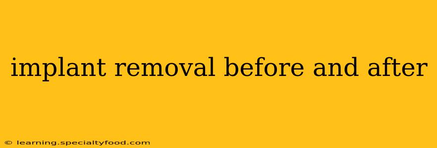 implant removal before and after