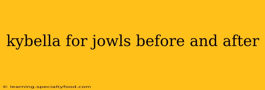 kybella for jowls before and after
