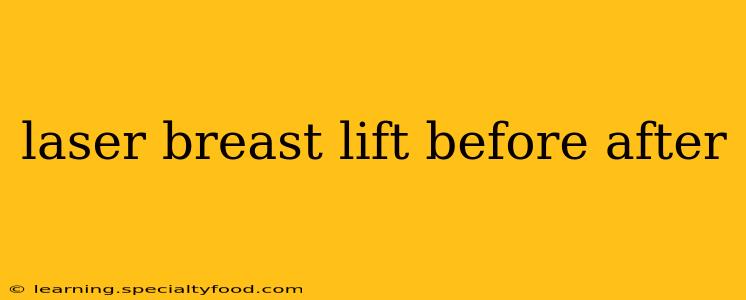 laser breast lift before after