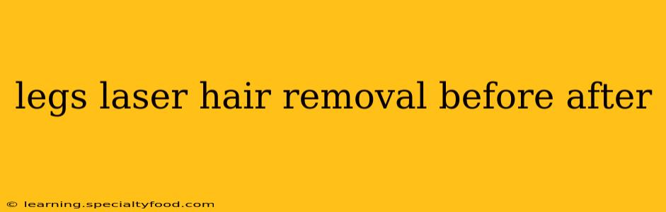legs laser hair removal before after