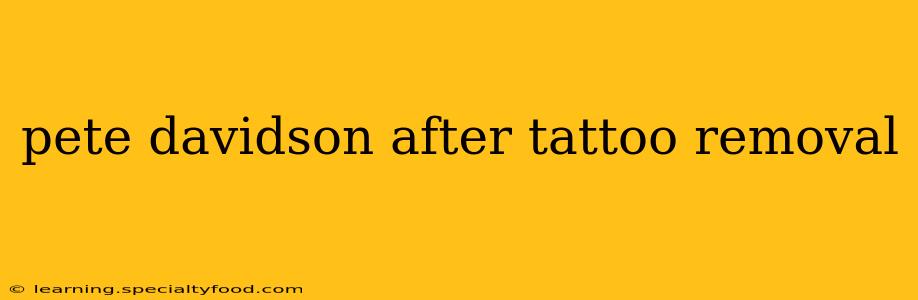 pete davidson after tattoo removal