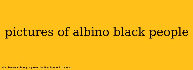 pictures of albino black people