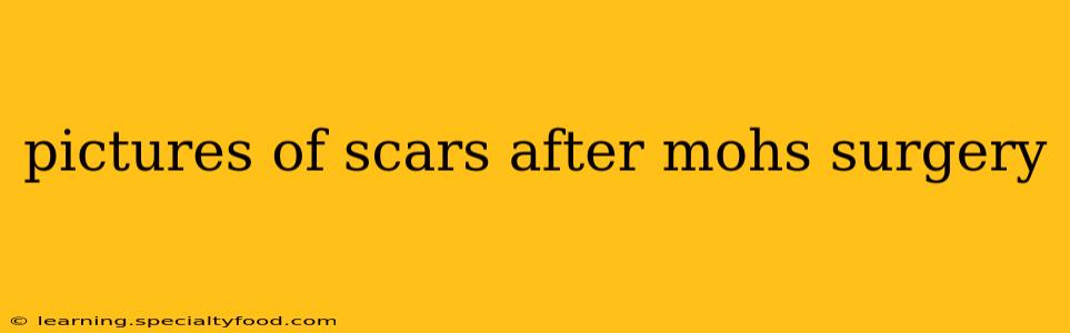 pictures of scars after mohs surgery
