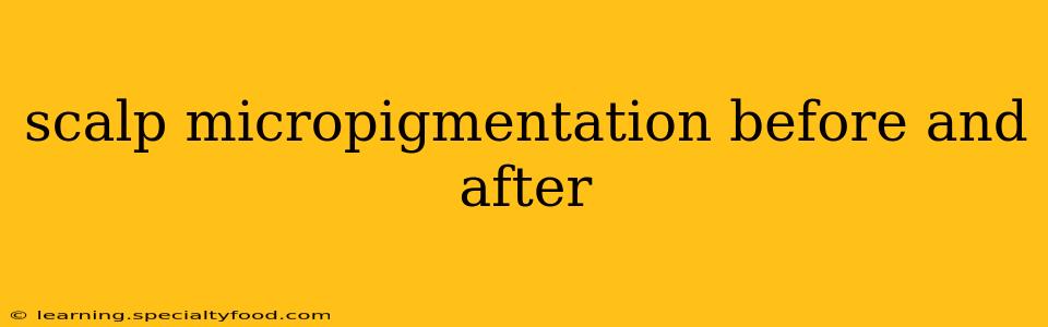 scalp micropigmentation before and after