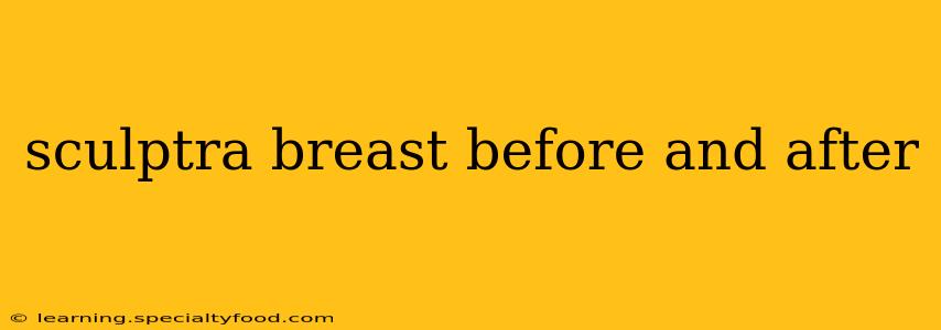 sculptra breast before and after