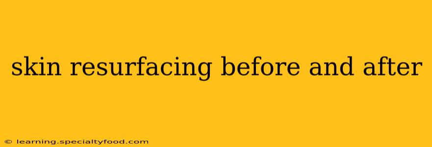 skin resurfacing before and after