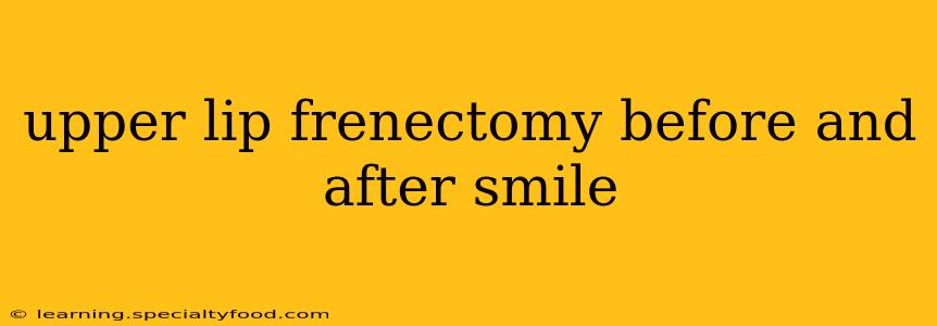 upper lip frenectomy before and after smile
