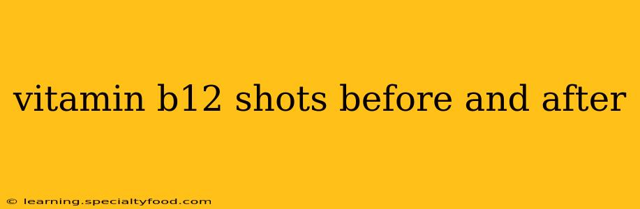 vitamin b12 shots before and after