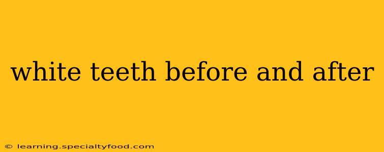 white teeth before and after