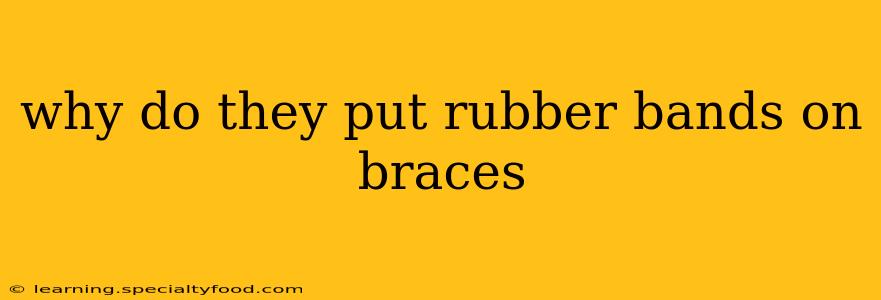 why do they put rubber bands on braces